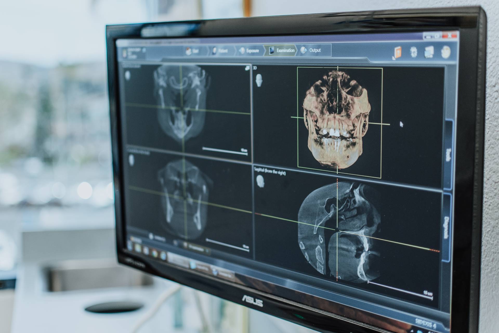 CBCT 3d Imaging